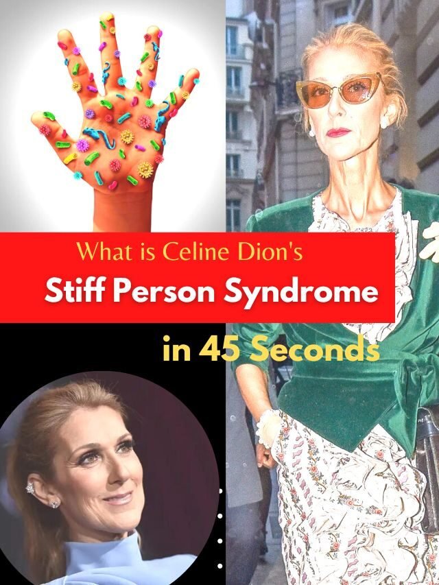 What is Celine Dion’s stiff person syndrome?