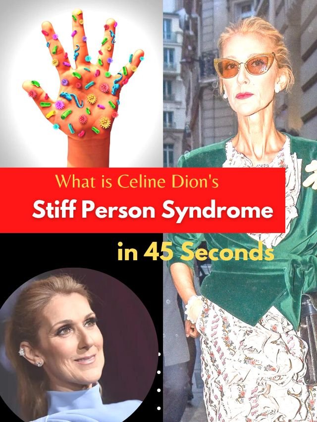 Celine Dion Stiff Person Syndrome